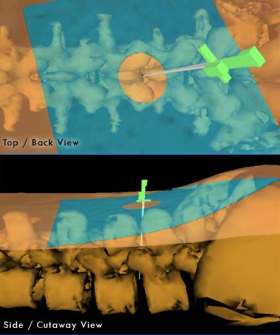 Lumbar Puncture Simulator